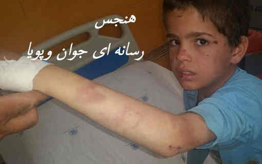 جزئیات تازه از ماجرای کتک زدن دانش آموز کوهدشتی/ریاست آموزش و پرورش کوهدشت: قضیه آن چنان که رسانه ها منتشر کردند،نیست!