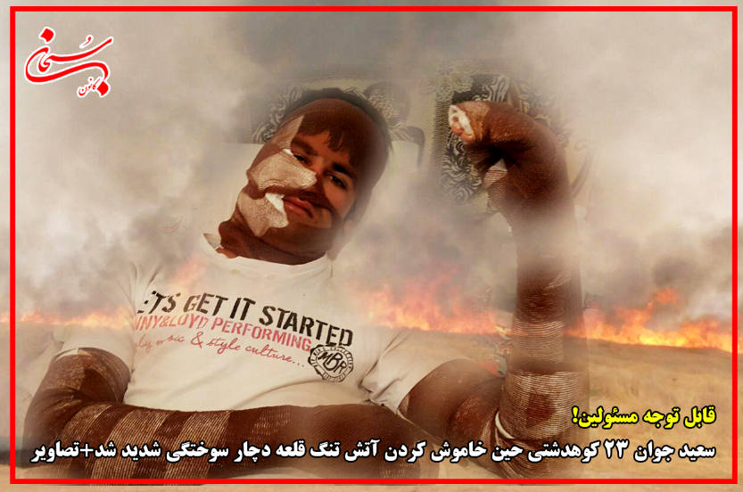 سعید جوان 23 کوهدشتی ،حین خاموش کردن آتش تنگ قلعه دچار سوختگی شدید شد+تصاویر